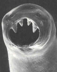 Ancylostoma