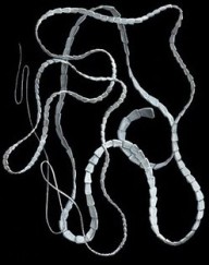 Tenias o gusanos chatos