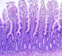 Corte histol&oacute;gico de yeyuno normal