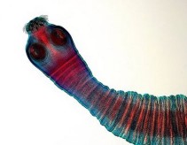 Tenia Echinoccocus